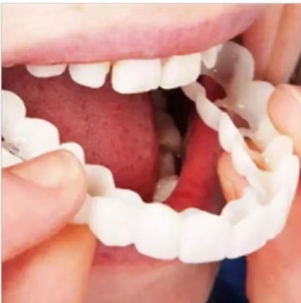 CARILLAS DENTALES-SNAP ON SMILE