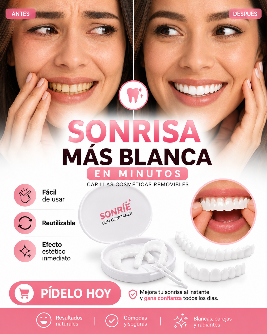 CARILLAS DENTALES-SNAP ON SMILE